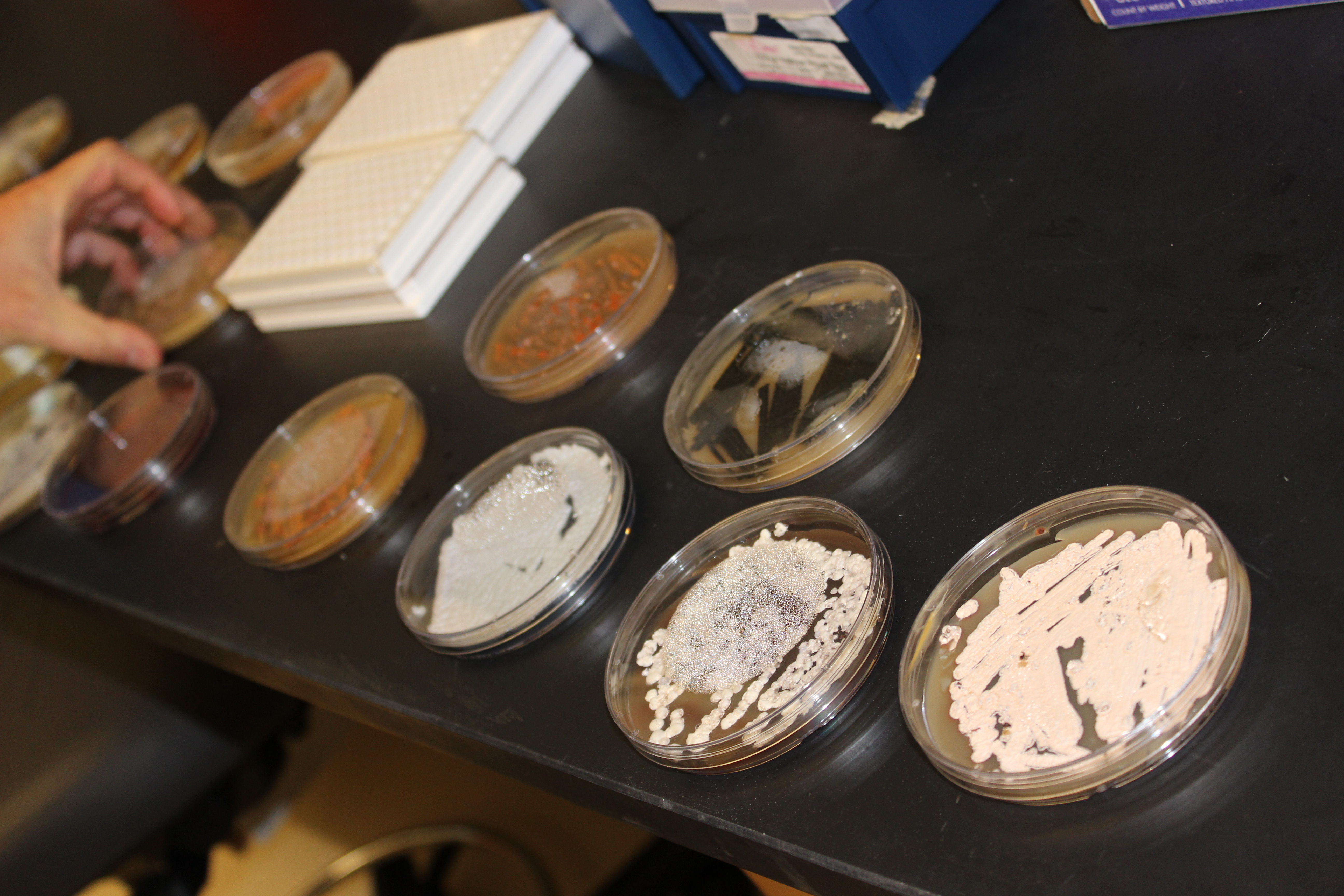 Bacteria samples